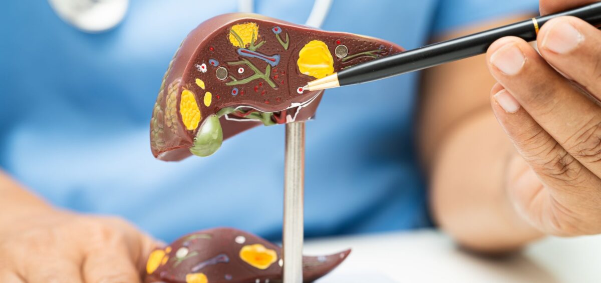 Fibrosis-como-detectarla